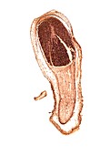 Liverwort (Riccardia sp.) sporophyte