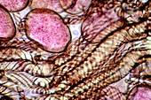 Liverwort (Conocephalum conicum) spores