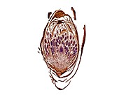 Moss perigonium,light micrograph