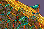 Moss,light micrograph