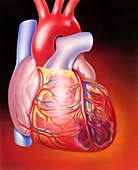 Myocardial infarction,illustration