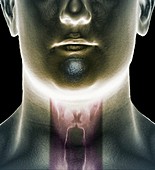 Vocal cords,composite 3D image