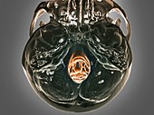 Normal skull,3D CT scan