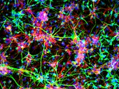 Neural stem cells,light micrograph