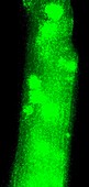 Heart muscle calcium sparks,micrograph