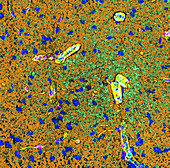 Brain blood vessels,light micrograph