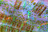 Diatoma diatoms,light micrograph