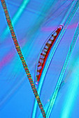 Diatom on cyanobacteria,light micrograph