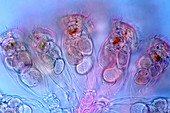 Conochilus rotifers,light micrograph