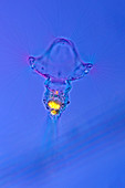 Collotheca rotifer,light micrograph
