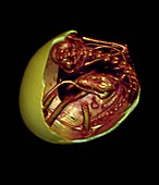 Egg and embryo skeleton,CT scan