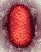 Orf virus particle,TEM