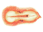 Embryo,illustration