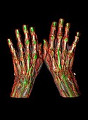 Human hands,CT scan