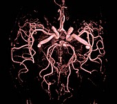 Brain arteries,MRI angiography