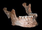 King Philip II of Macedon's jaw bone