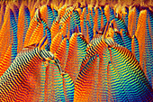 Vitamin C,light micrograph