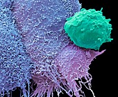 Cancer cells and monocyte,SEM
