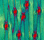 Iris stomata,light micrograph