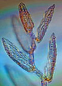 Sphagnum moss leaves,light micrograph