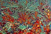 Haematoxylin crystals,light micrograph