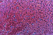 Tannic acid crystals,light micrograph