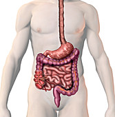 Crohn's Disease,illustration