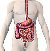 Diverticulum,illustration