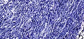 Nerve tissue,light micrograph