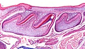 Fetal teeth,light micrograph