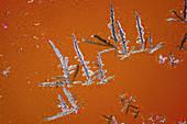Uric acid crystals,light micrograph