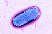 E. coli O55 bacterium,TEM