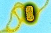 E. coli O55 bacterium,TEM