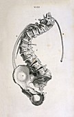 Spinal curvature,18th century