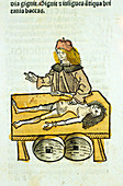 Medieval surgery,15th century