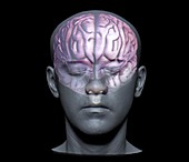Normal brain,3D MRI scan