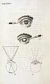 Eye surgery,18th century