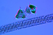 Diatoms and desmids,light micrograph
