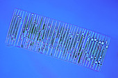 Fragilaria diatoms,light micrograph