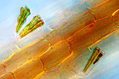 Diatoms on duckweed,light micrograph