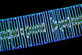 Fragilaria diatoms,light micrograph