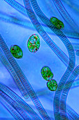 Euglena protozoa and cyanobacteria