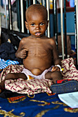 Malnourished child,Sierra Leone