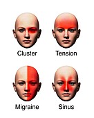 Headache types,illustration
