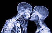 Lovers kissing,X-ray