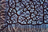 Cholesterol crystals,light micrograph