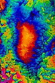 Dopamine drug crystals,light micrograph