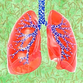 Respiratory medicine,illustration