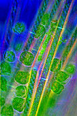 Diatoms and Spirogyra algae,micrograph