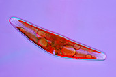 Cymbella diatom,light micrograph